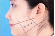 点打在中间方法是什么？如何正确使用？