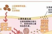 打印机清理黑色素的有效方法（解决打印机黑色墨水问题）