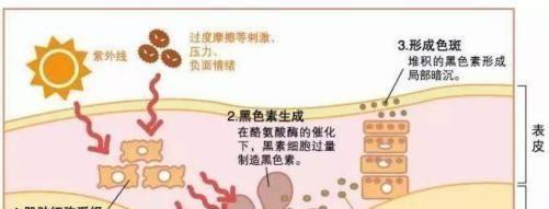 打印机清理黑色素的有效方法（解决打印机黑色墨水问题）