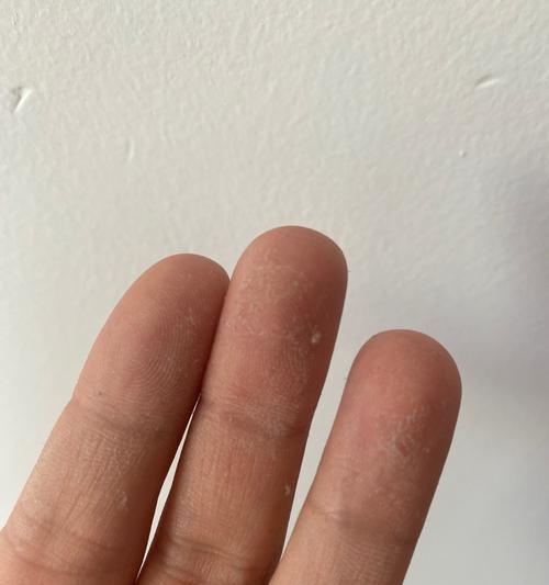 解析热水器出现R9的原因（深入探讨热水器故障代码R9）