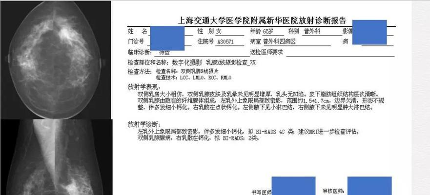 电脑显示屏频闪如何检查？配置问题如何诊断？