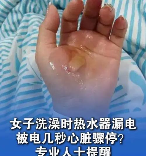 热水器漏电故障如何快速修复？