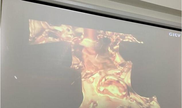 如何解决投影仪屏幕字体晃动问题（消除投影字体晃动，提高视觉体验）