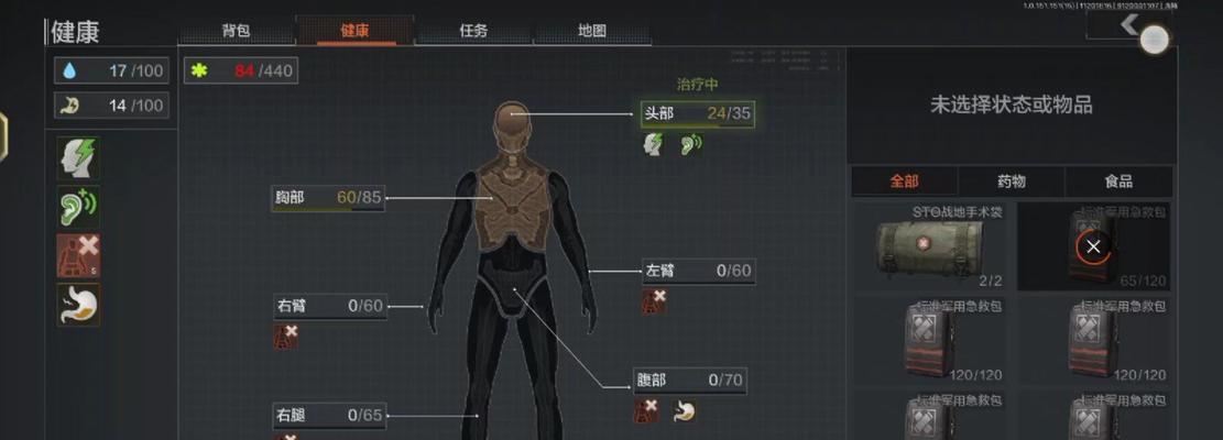 暗区突围散热器的选择标准是什么？如何挑选？